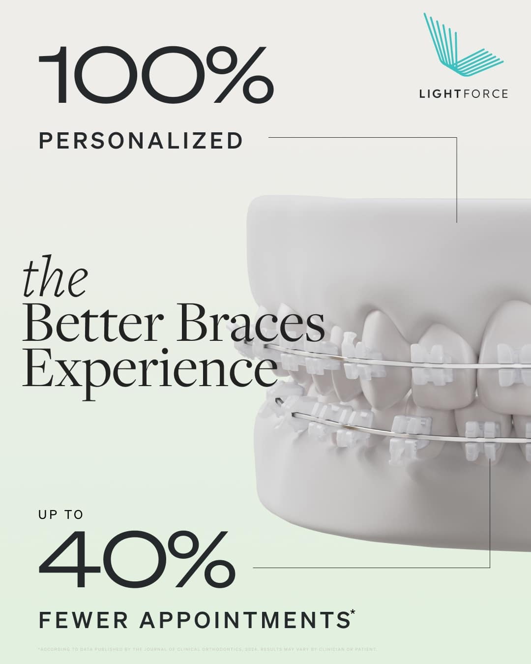 LightForce 3D Printed Custom Aesthetic Braces Orthodontist 2