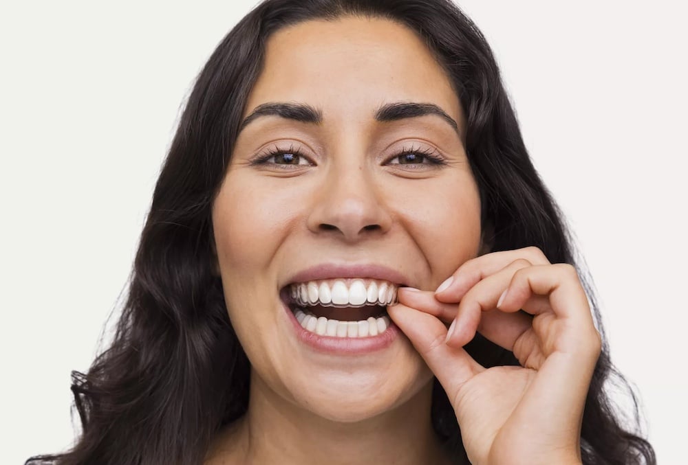 spark clear aligners