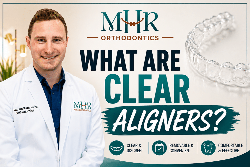 What Are Clear Aligners?