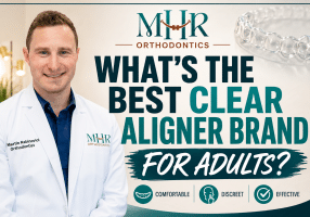 What’s the Best Clear Aligner Brand for Adults?