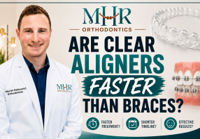 Are Clear Aligners Faster Than Braces?