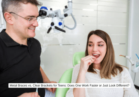 Metal Braces vs. Clear Brackets for Teens Does One Work Faster or Just Look Different